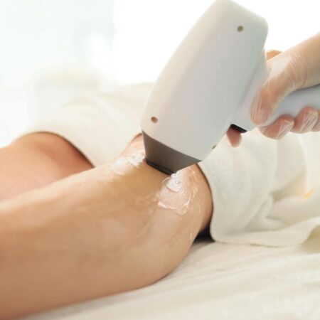 laser hair removal in Cape Girardeau