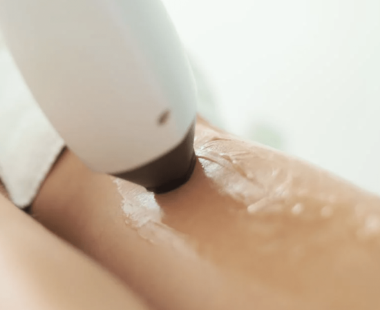 laser hair removal in Cape Girardeau MO laser hair removal in Cape Girardeau MO